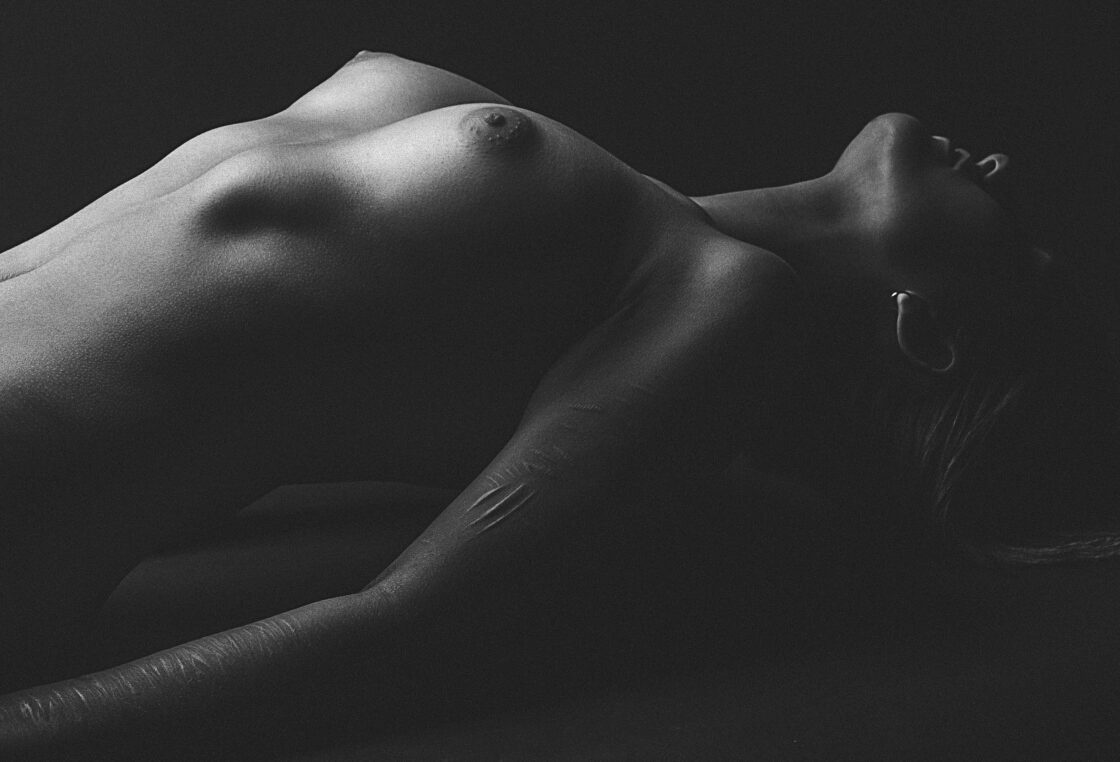 SCARS
